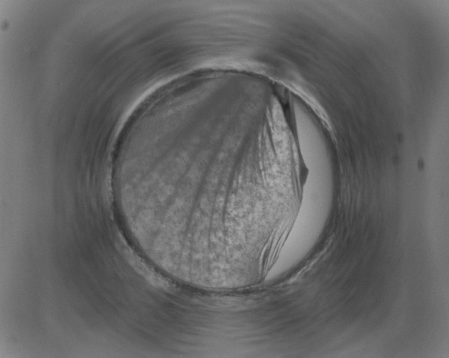 X0000081470976200702092336