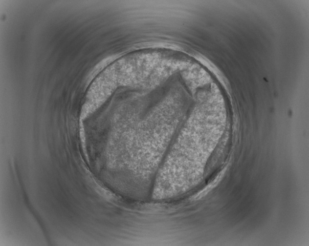 X0000081470993200702092335