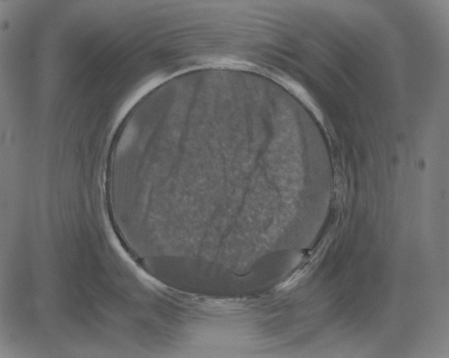 X0000081471007200702092335