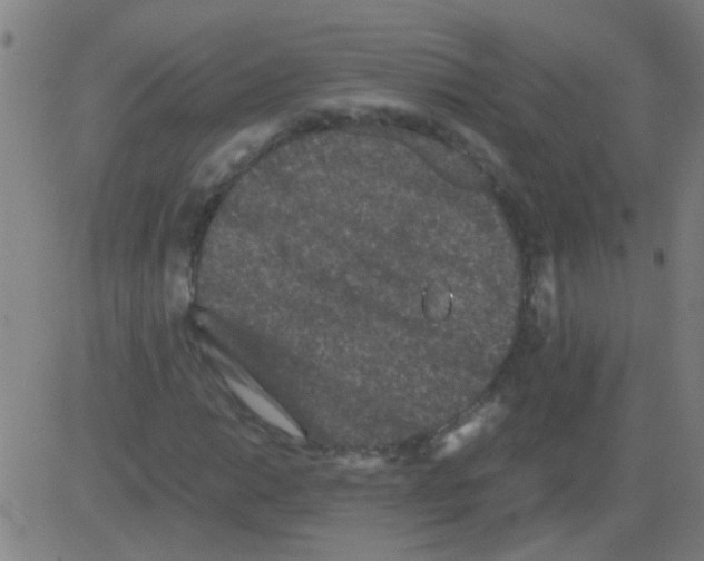 X0000081471014200702092334