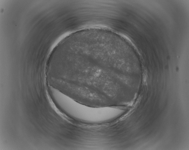 X0000081471038200702092335