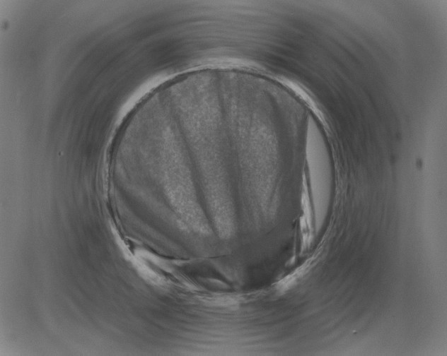 X0000081471046200702092335