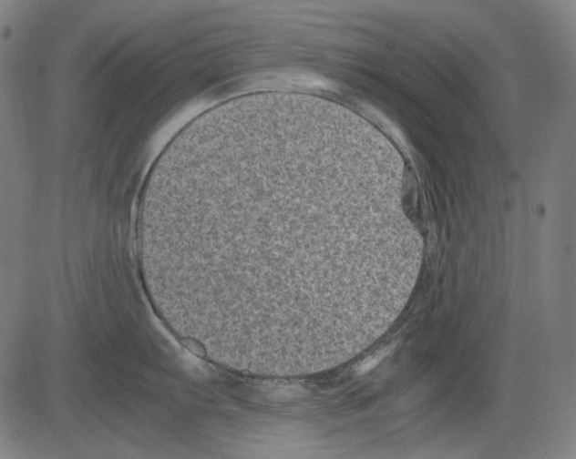 X0000081471103200702092333