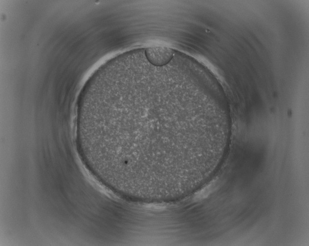 X0000081471126200702092333