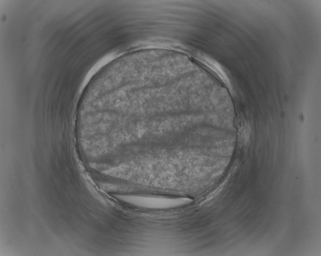 X0000081471146200702092333