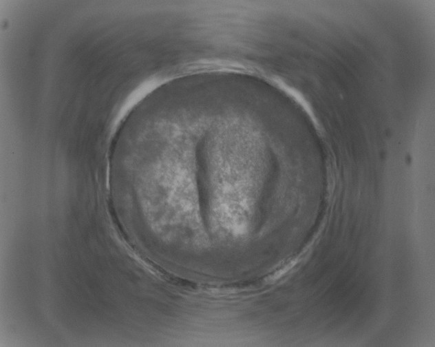 X0000081471365200702092329