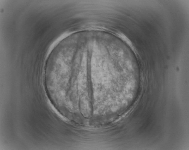 X0000081471379200702092329