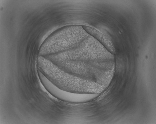 X0000081471390200702092329