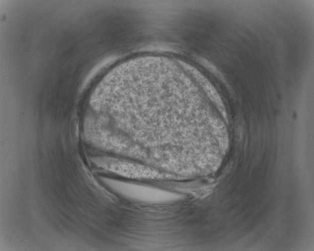 X0000081471408200702092328