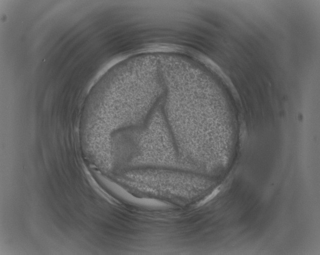 X0000081471417200702092328