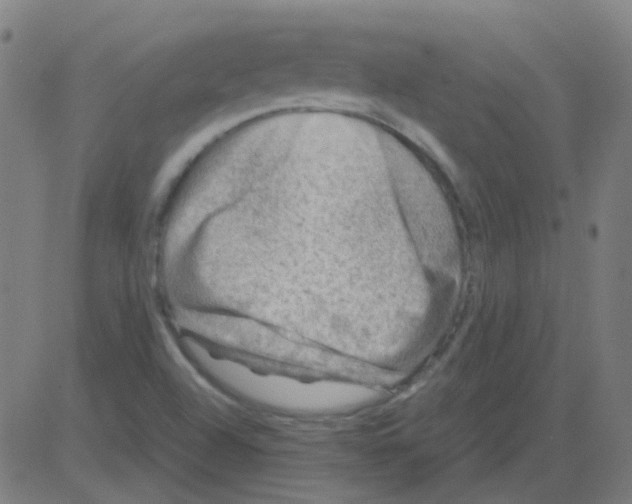 X0000081471504200702092327