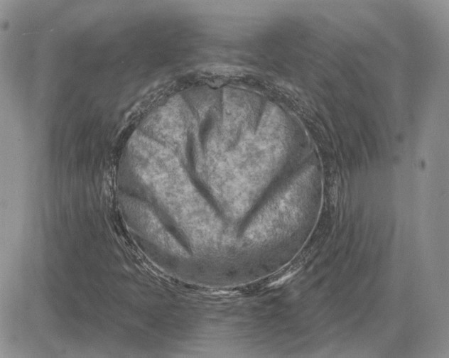 X0000081481397200701262016