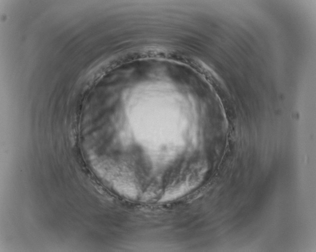 X0000081491015200701262048