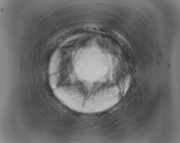 X0000081491015200702021917