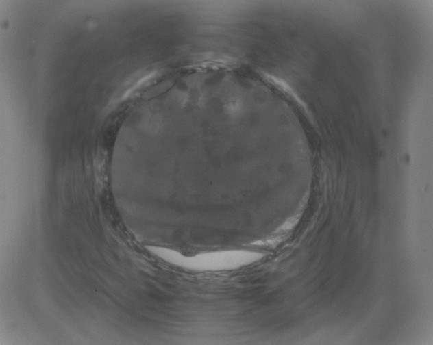 X0000081491399200702021911