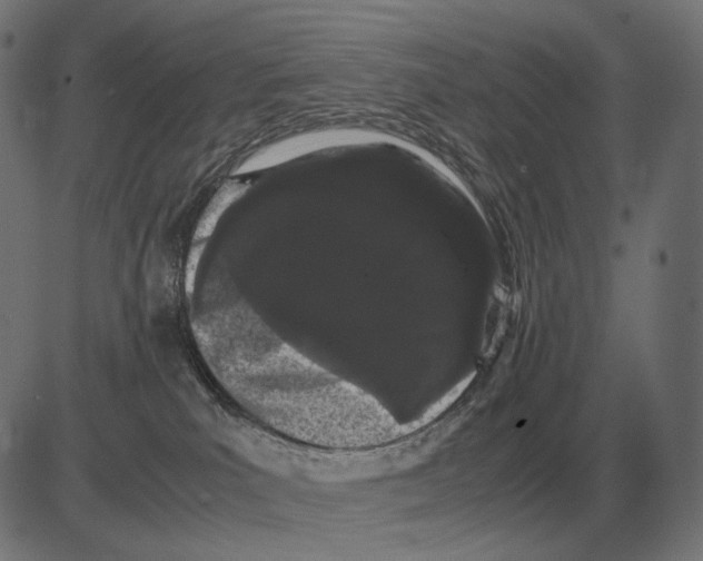 X0000081490039200702100041