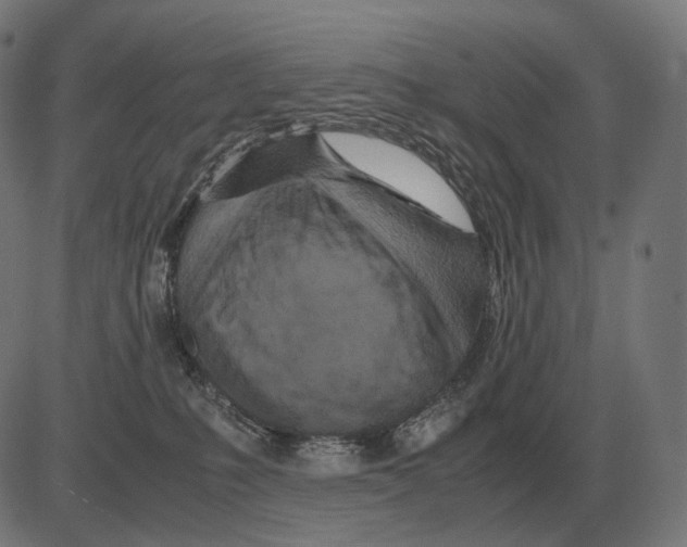 X0000081490231200702100038