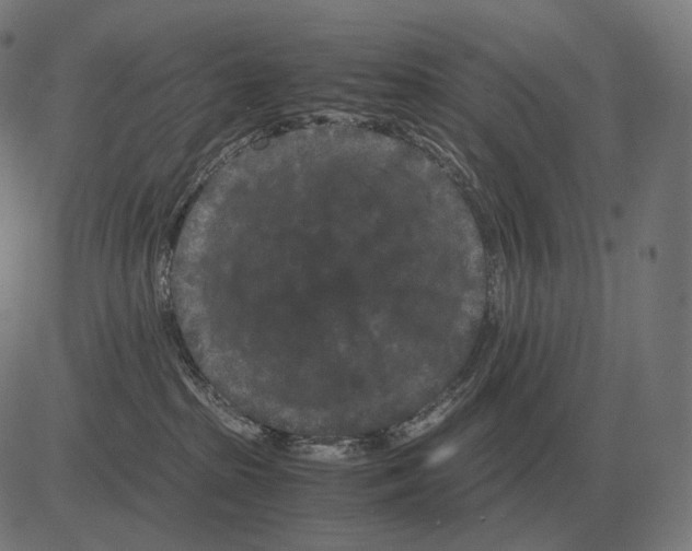 X0000081490285200702100038