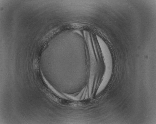 X0000081490317200702100036