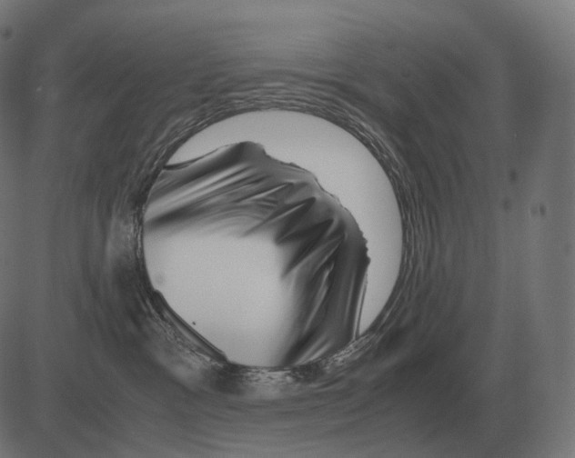 X0000081490333200702100036