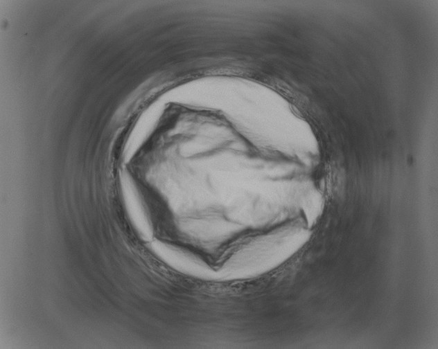 X0000081490339200702100035