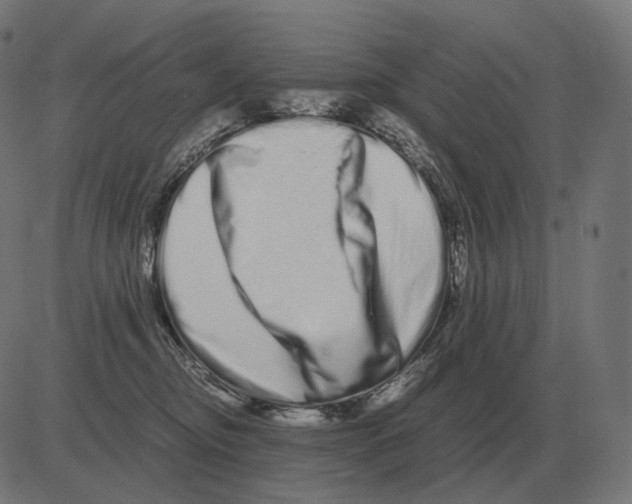 X0000081490374200702100036