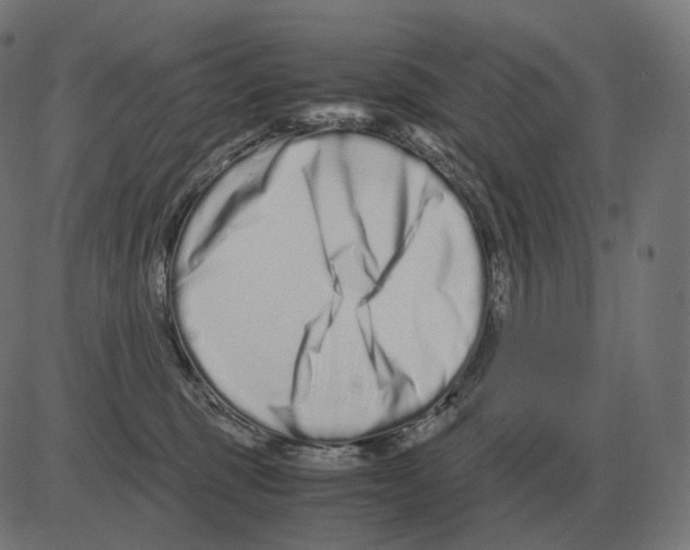 X0000081490375200702100036