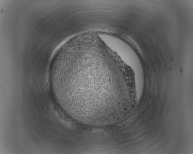 X0000081490388200702100035