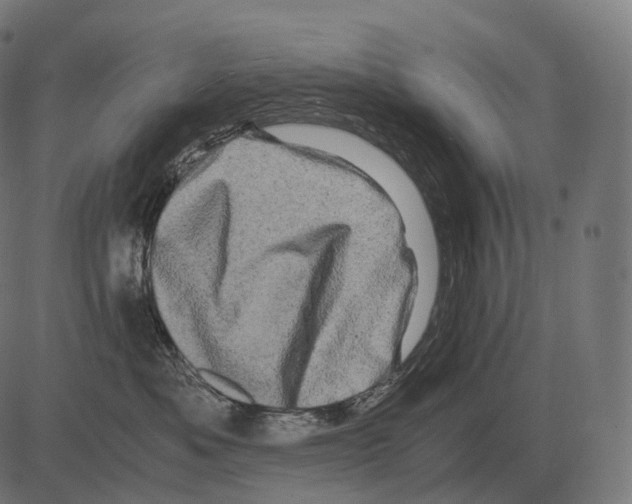 X0000081490525200702100033