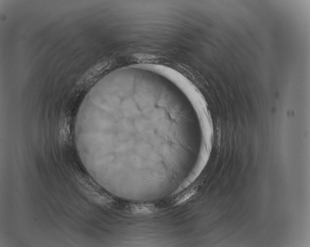 X0000081490618200702100031