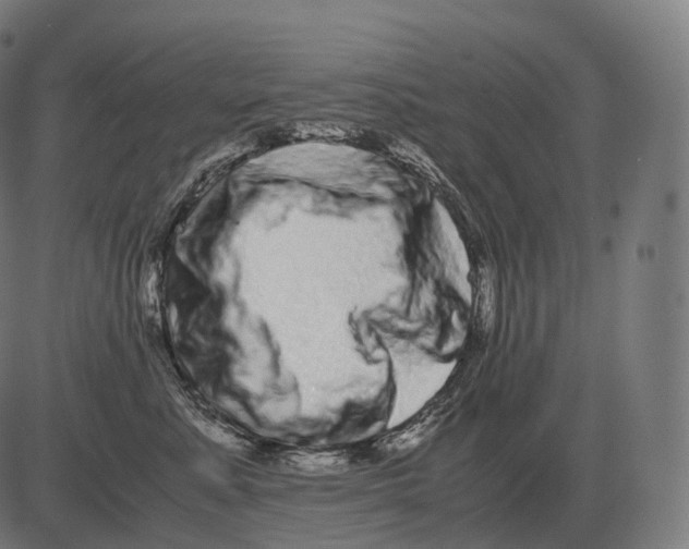 X0000081490619200702100031