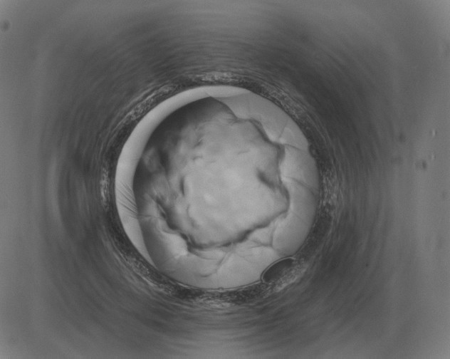 X0000081490648200702100031