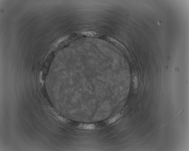 X0000081490665200702100031