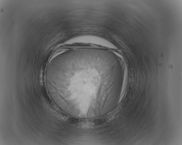 X0000081490696200702100030