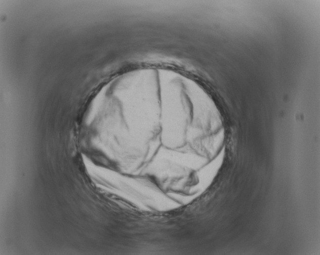 X0000081491493200702100017