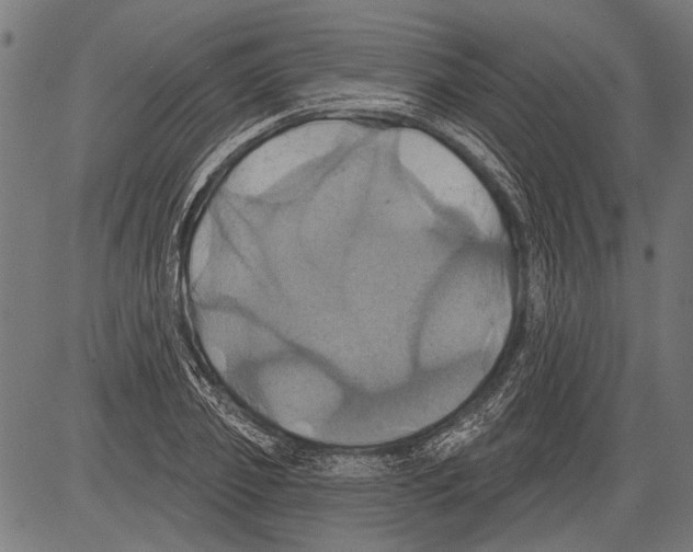 X0000081500933200702100052