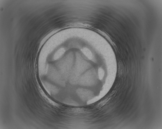 X0000081501387200702100045