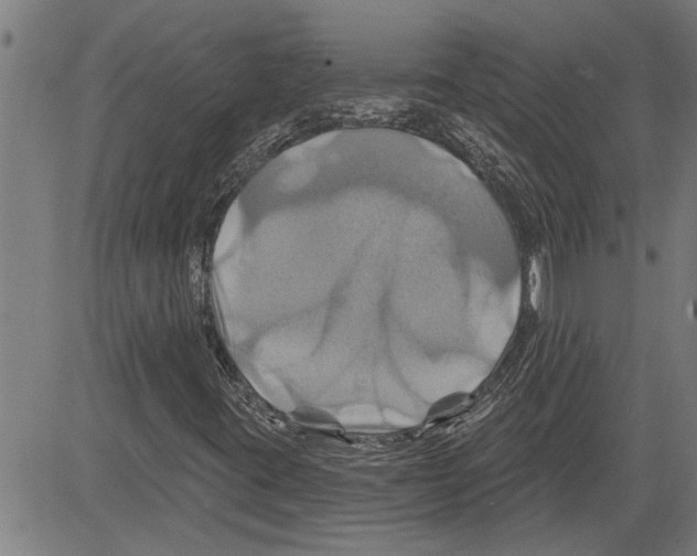 X0000081501395200702100044