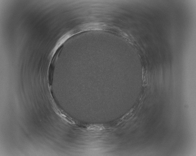 X0000081560099200701221037