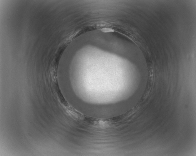 X0000081560419200701221032