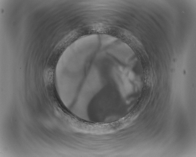 X0000081560036200702051200