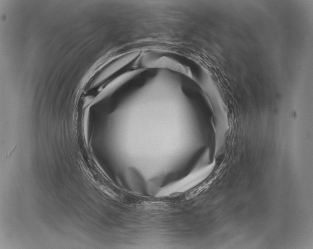 X0000081560150200702051158