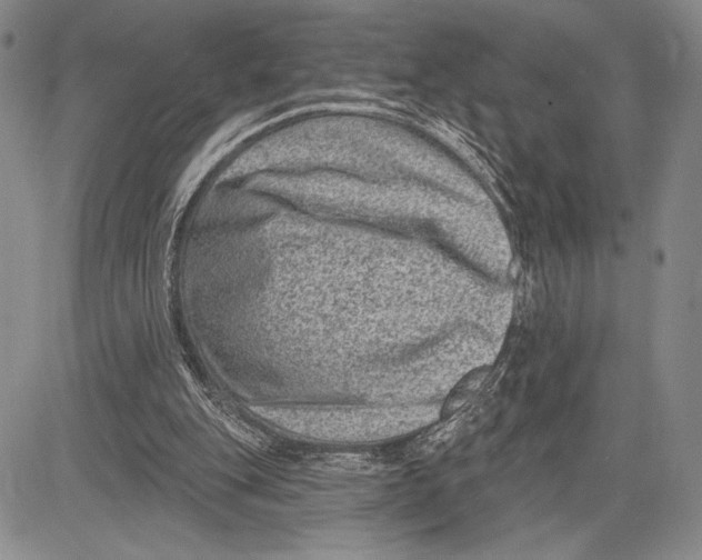 X0000081560151200702051158