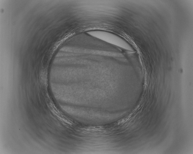 X0000081560386200702051154