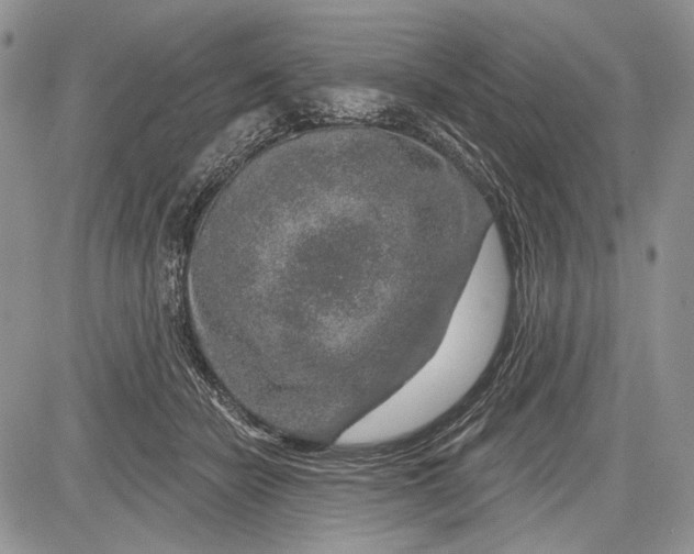 X0000081560462200702051153