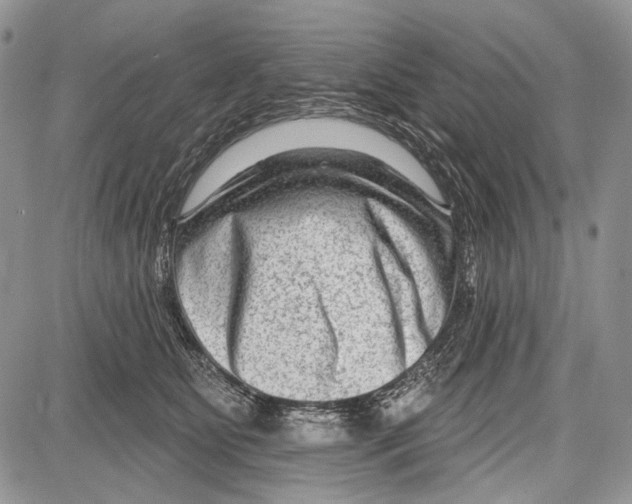 X0000081560515200702051152