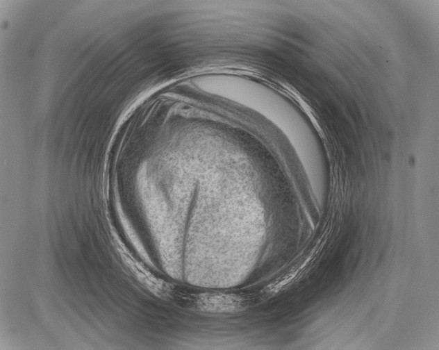 X0000081560795200702051148