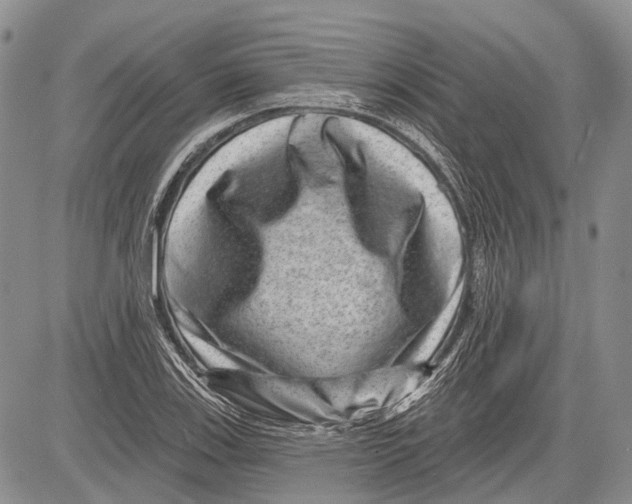 X0000081561123200702051142