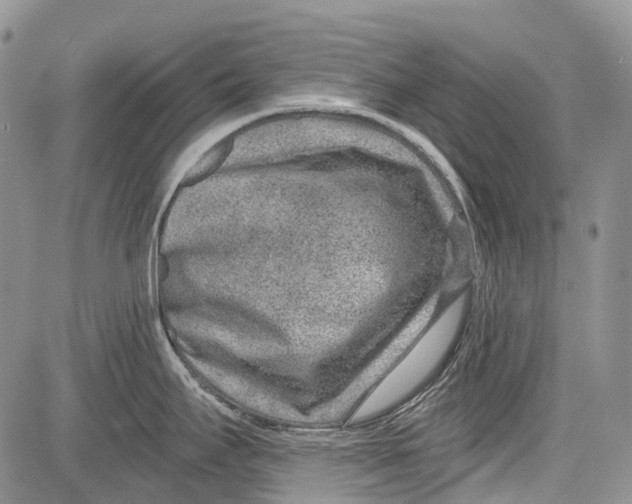 X0000081561295200702051140