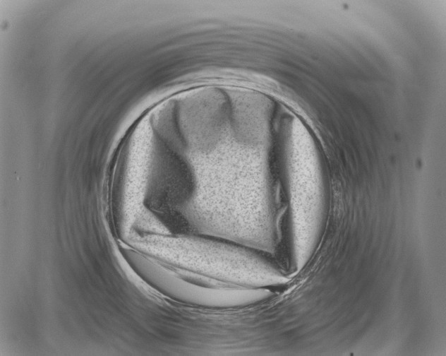 X0000081561531200702051136